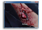 EMR - Orthopedic Trauma - DVD or USB